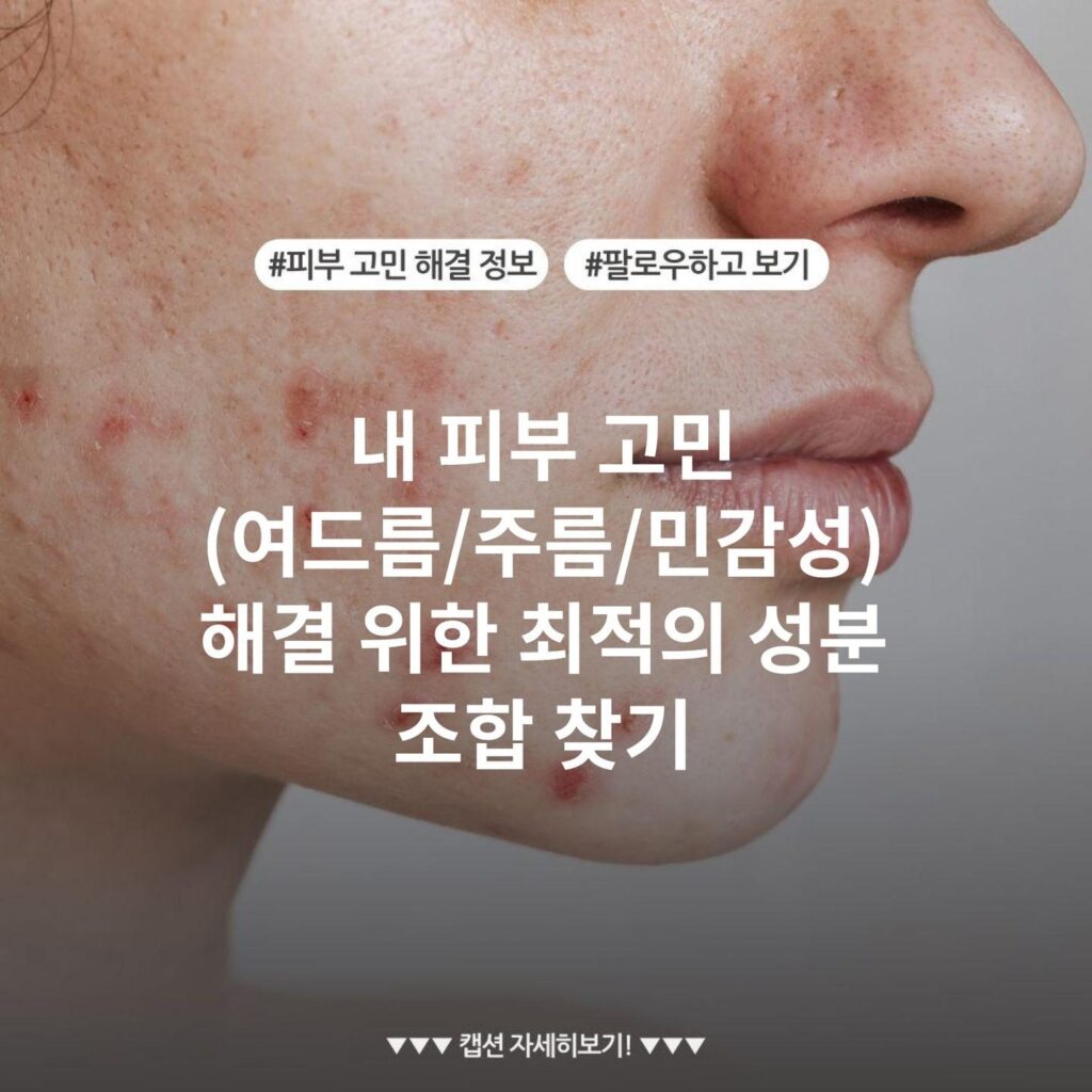 내 피부 고민(여드름/주름/민감성) 해결 위한 최적의 성분 조합 찾기