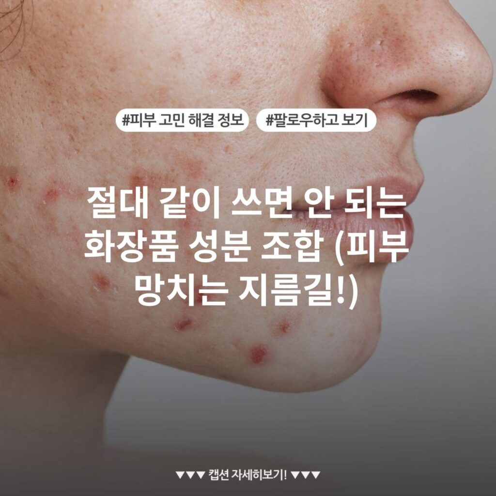 절대 같이 쓰면 안 되는 화장품 성분 조합 (피부 망치는 지름길!)