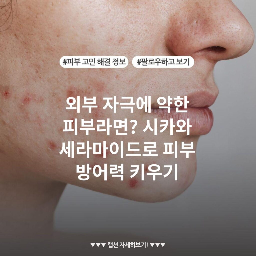 외부 자극에 약한 피부라면? 시카와 세라마이드로 피부 방어력 키우기