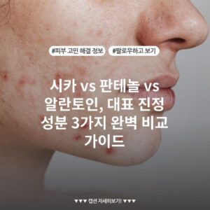 시카 vs 판테놀 vs 알란토인, 대표 진정 성분 3가지 완벽 비교 가이드