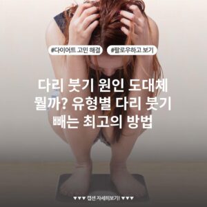 다리 붓기 원인 도대체 뭘까? 유형별 다리 붓기 빼는 최고의 방법