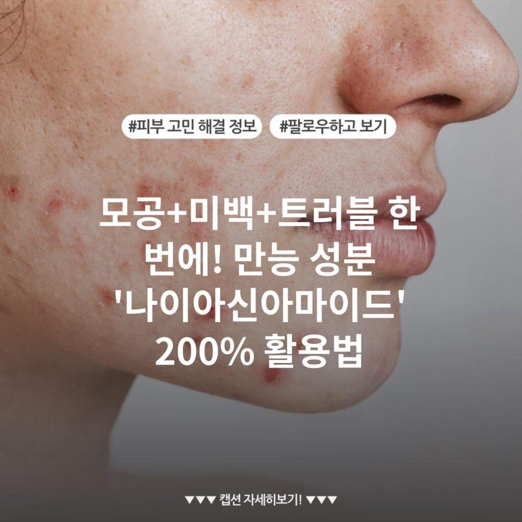 모공+미백+트러블 한 번에! 만능 성분 '나이아신아마이드' 200% 활용법
