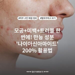 모공+미백+트러블 한 번에! 만능 성분 '나이아신아마이드' 200% 활용법