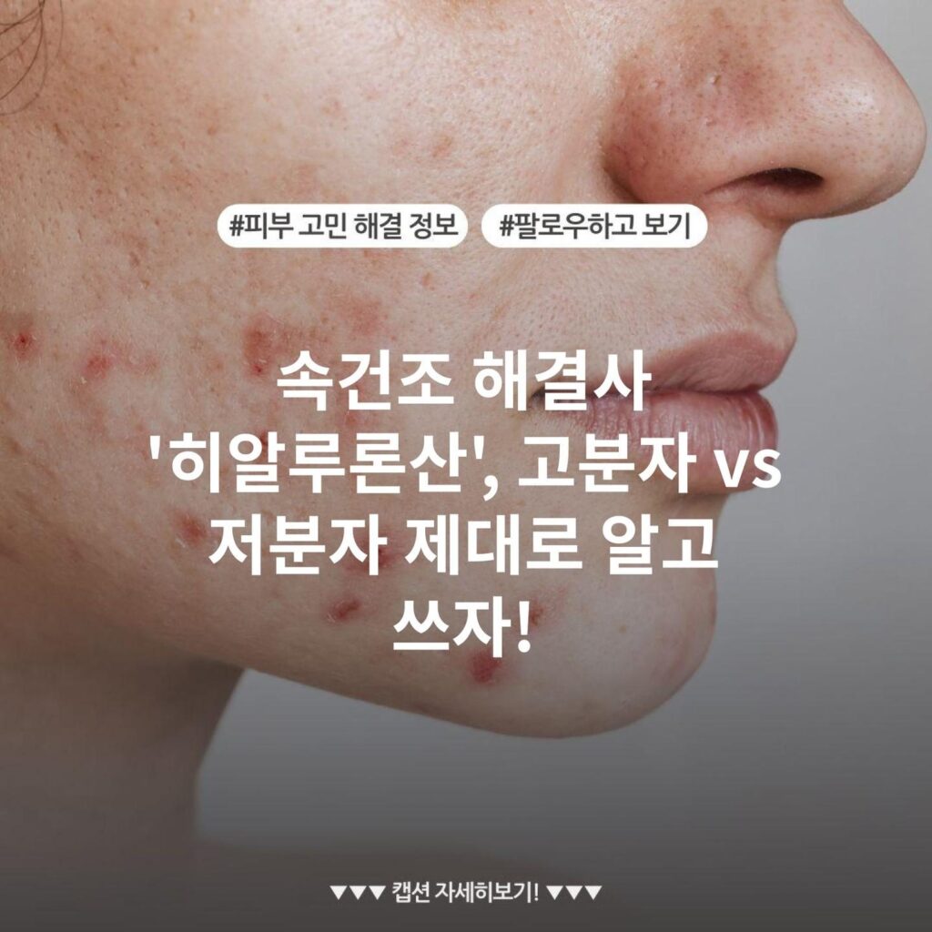 속건조 해결사 '히알루론산', 고분자 vs 저분자 제대로 알고 쓰자!
