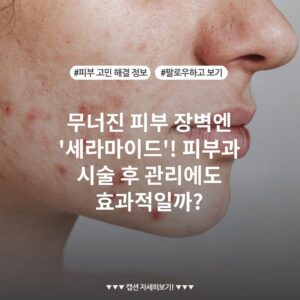 무너진 피부 장벽엔 '세라마이드'! 피부과 시술 후 관리에도 효과적일까?