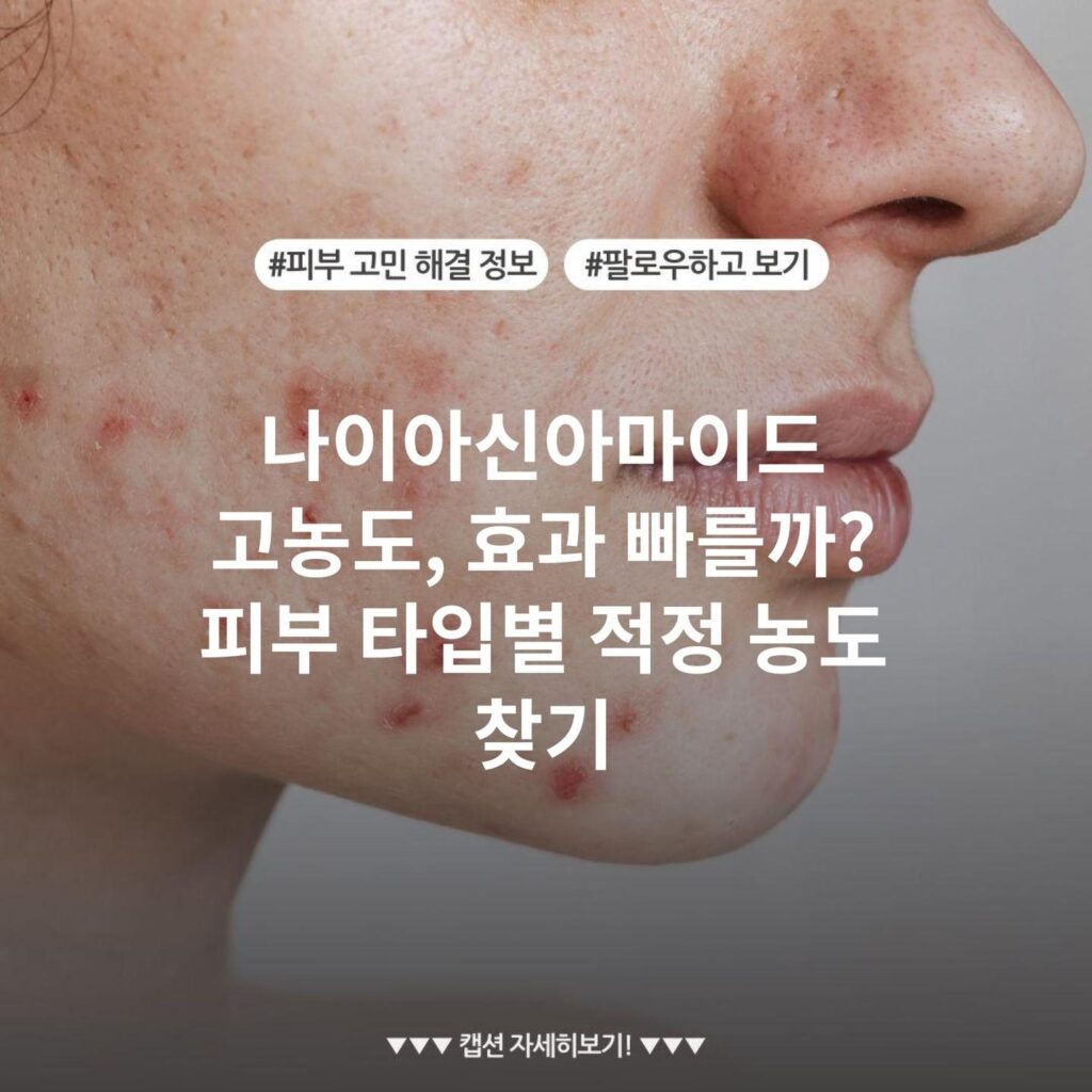 나이아신아마이드 고농도, 효과 빠를까? 피부 타입별 적정 농도 찾기