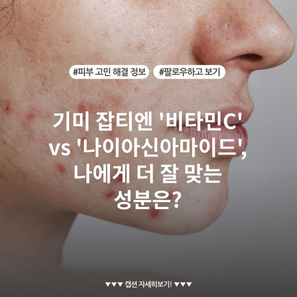 기미 잡티엔 '비타민C' vs '나이아신아마이드', 나에게 더 잘 맞는 성분은?
