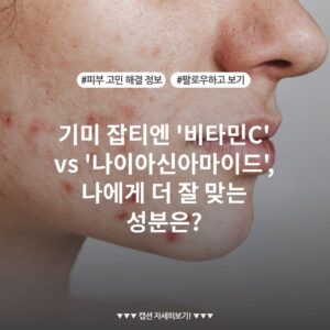 기미 잡티엔 '비타민C' vs '나이아신아마이드', 나에게 더 잘 맞는 성분은?