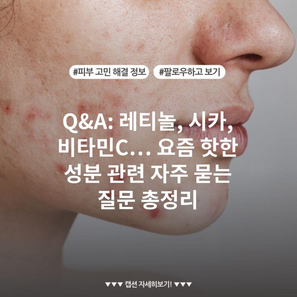Q&A: 레티놀, 시카, 비타민C… 요즘 핫한 성분 관련 자주 묻는 질문 총정리