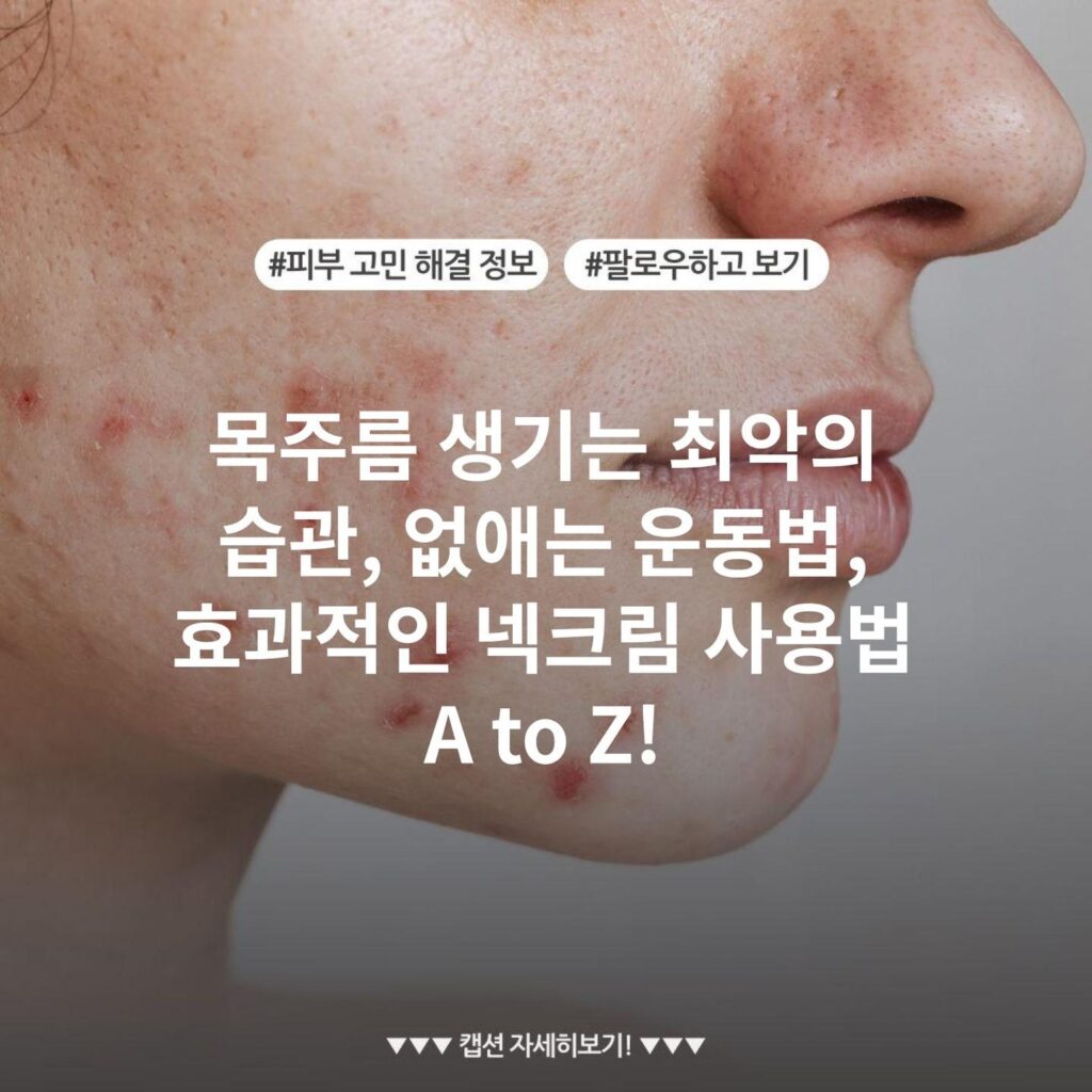 목주름 생기는 최악의 습관, 없애는 운동법, 효과적인 넥크림 사용법 A to Z!