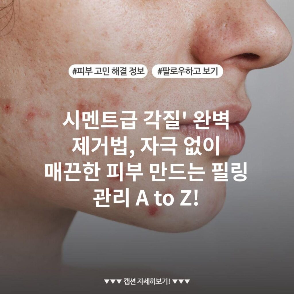 시멘트급 각질' 완벽 제거법, 자극 없이 매끈한 피부 만드는 필링 관리 A to Z!