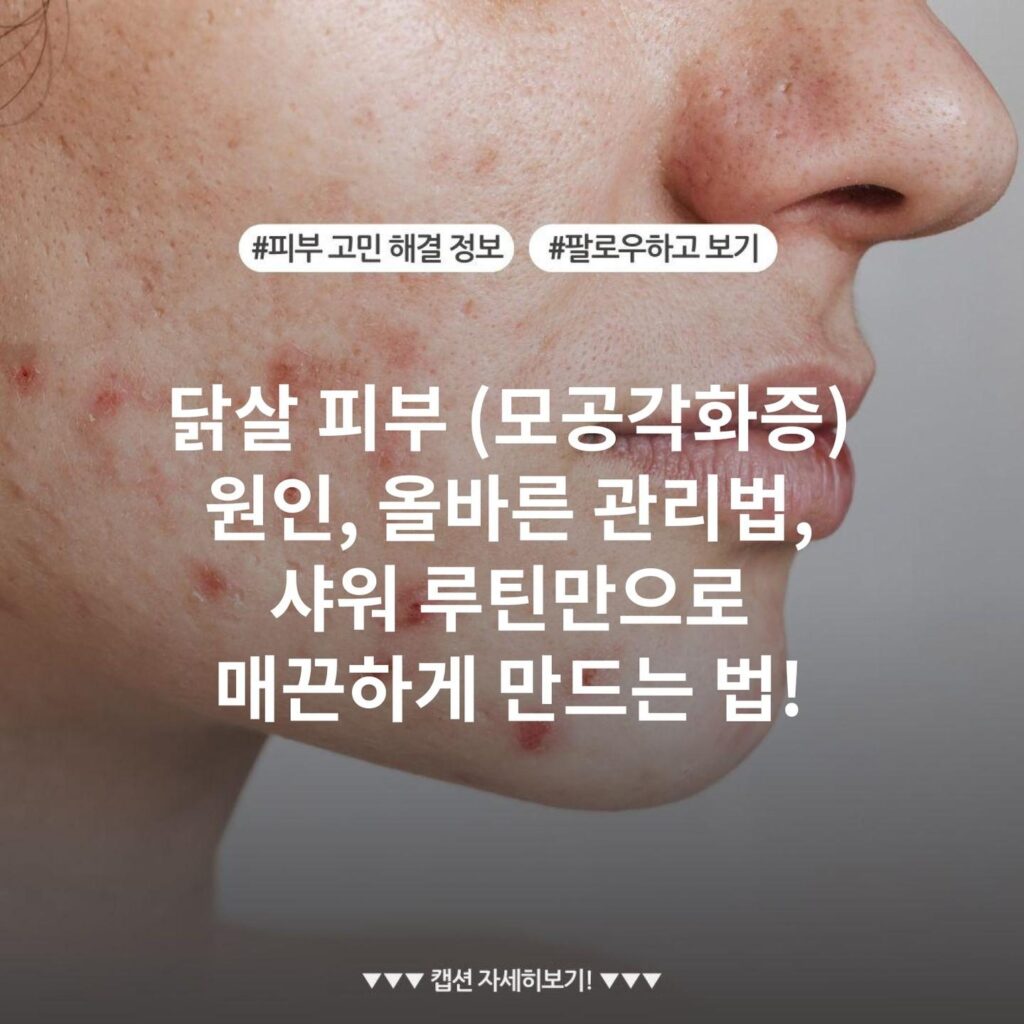 닭살 피부 (모공각화증) 원인, 올바른 관리법, 샤워 루틴만으로 매끈하게 만드는 법!