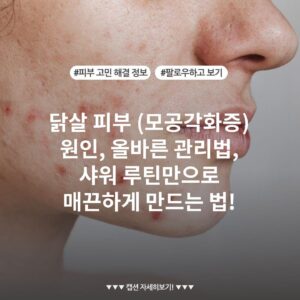닭살 피부 (모공각화증) 원인, 올바른 관리법, 샤워 루틴만으로 매끈하게 만드는 법!