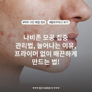 나비존 모공 집중 관리법, 늘어나는 이유, 프라이머 없이 매끈하게 만드는 법!