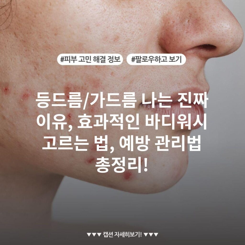 등드름/가드름 나는 진짜 이유, 효과적인 바디워시 고르는 법, 예방 관리법 총정리!