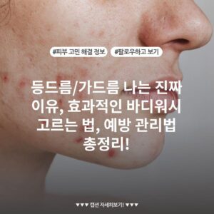 등드름/가드름 나는 진짜 이유, 효과적인 바디워시 고르는 법, 예방 관리법 총정리!