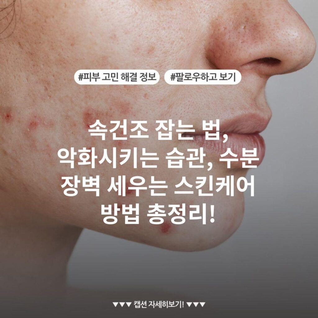 속건조 잡는 법, 악화시키는 습관, 수분 장벽 세우는 스킨케어 방법 총정리!