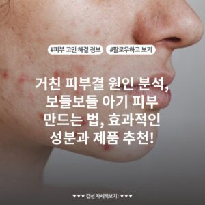 거친 피부결 원인 분석, 보들보들 아기 피부 만드는 법, 효과적인 성분과 제품 추천!
