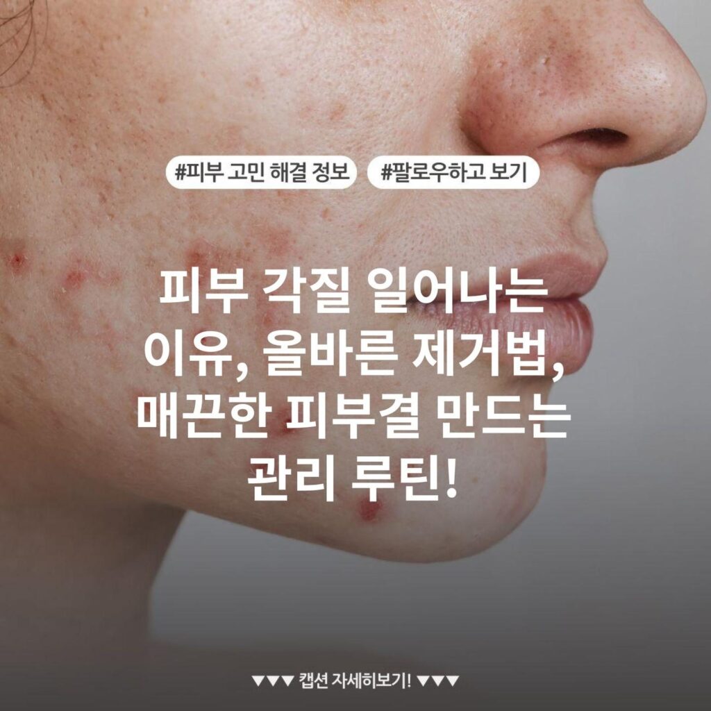 피부 각질 일어나는 이유, 올바른 제거법, 매끈한 피부결 만드는 관리 루틴!