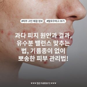 과다 피지 원인과 결과, 유수분 밸런스 맞추는 법, 기름종이 없이 뽀송한 피부 관리법!