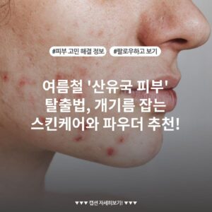 여름철 '산유국 피부' 탈출법, 개기름 잡는 스킨케어와 파우더 추천!