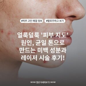 얼룩덜룩 '피부 지도' 원인, 균일 톤으로 만드는 미백 성분과 레이저 시술 후기!