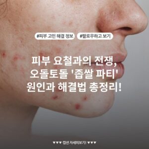 피부 요철과의 전쟁, 오돌토돌 '좁쌀 파티' 원인과 해결법 총정리!