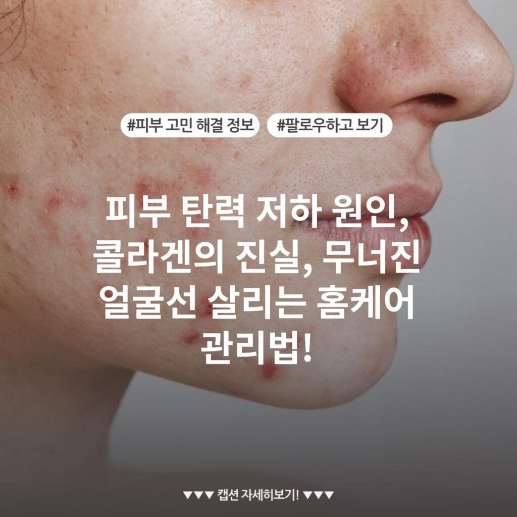 피부 탄력 저하 원인, 콜라겐의 진실, 무너진 얼굴선 살리는 홈케어 관리법!