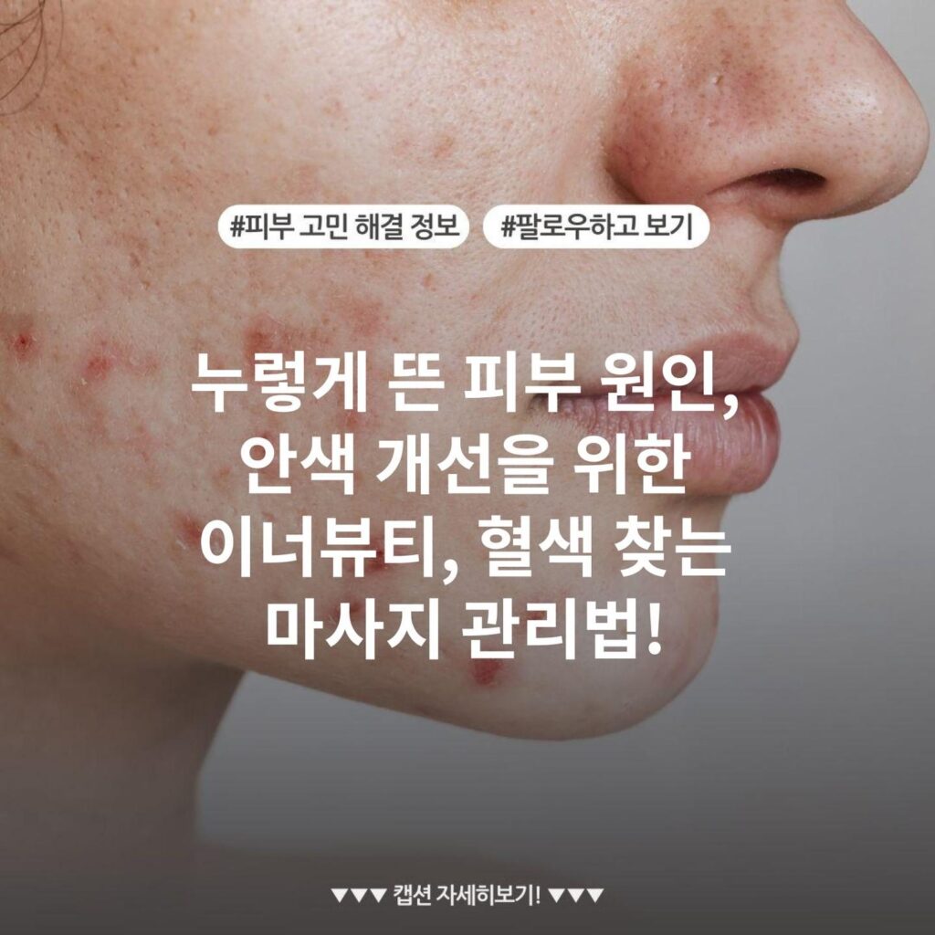 누렇게 뜬 피부 원인, 안색 개선을 위한 이너뷰티, 혈색 찾는 마사지 관리법!