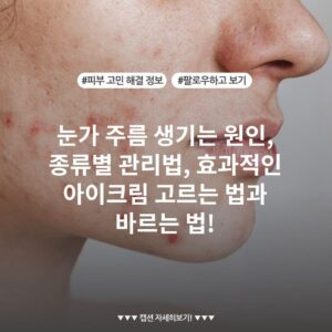눈가 주름 생기는 원인, 종류별 관리법, 효과적인 아이크림 고르는 법과 바르는 법!