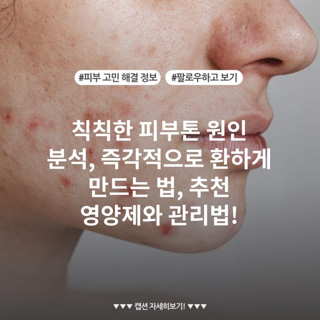 칙칙한 피부톤 원인 분석, 즉각적으로 환하게 만드는 법, 추천 영양제와 관리법!