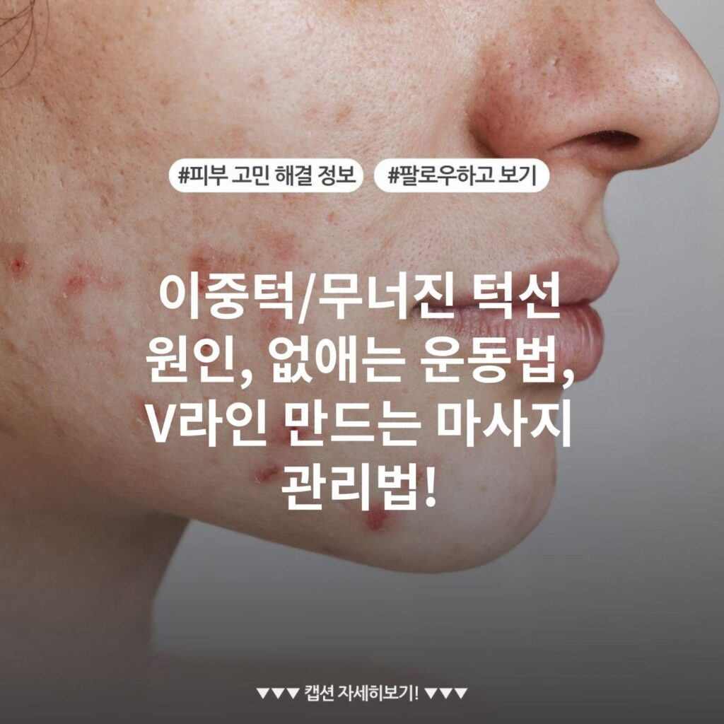이중턱/무너진 턱선 원인, 없애는 운동법, V라인 만드는 마사지 관리법!