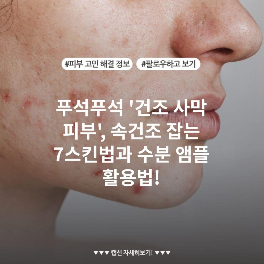 푸석푸석 '건조 사막 피부', 속건조 잡는 7스킨법과 수분 앰플 활용법!
