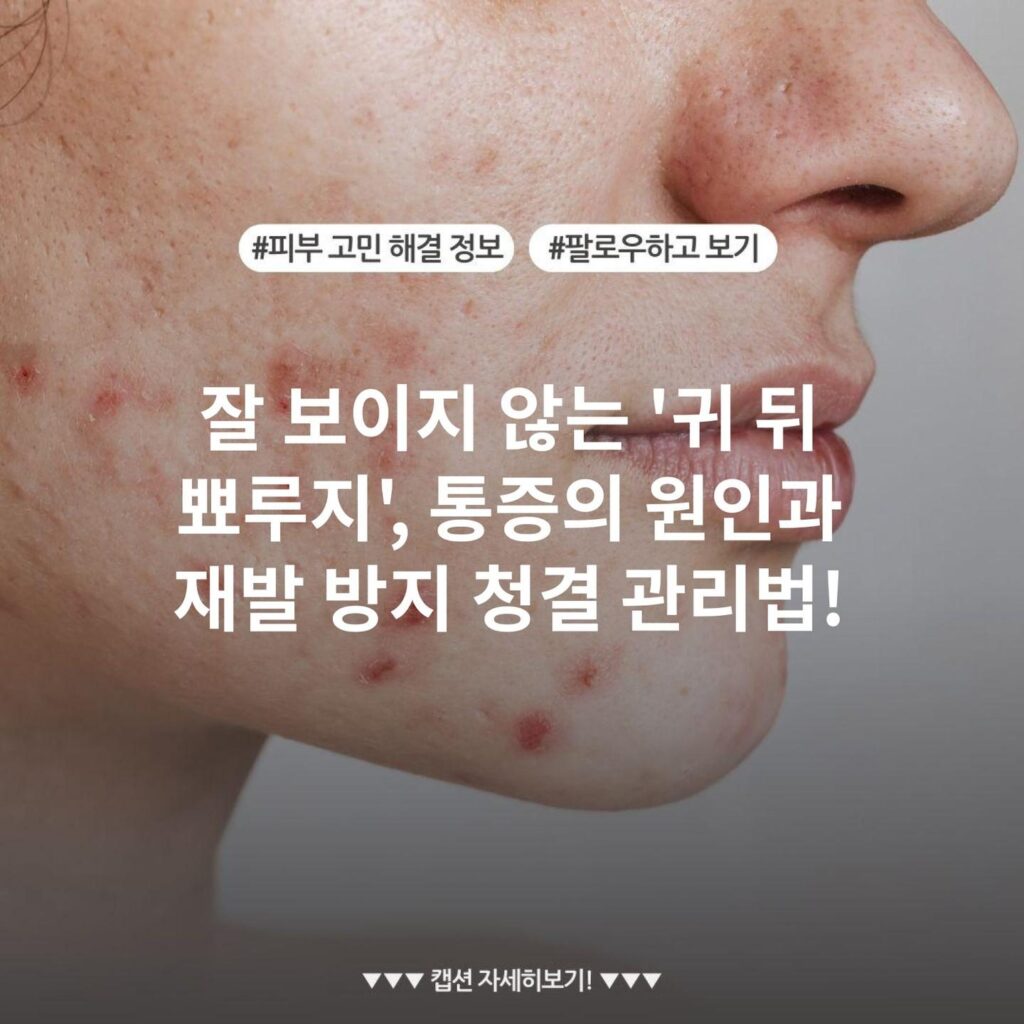 잘 보이지 않는 '귀 뒤 뾰루지', 통증의 원인과 재발 방지 청결 관리법!