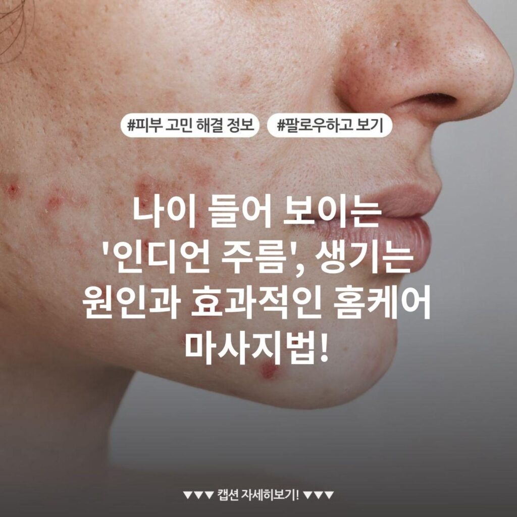 나이 들어 보이는 '인디언 주름', 생기는 원인과 효과적인 홈케어 마사지법!