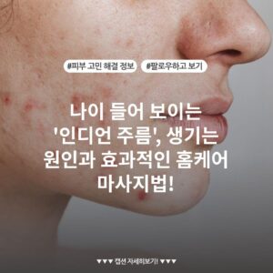 나이 들어 보이는 '인디언 주름', 생기는 원인과 효과적인 홈케어 마사지법!