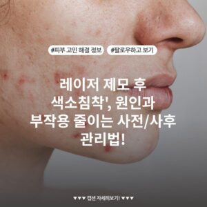 레이저 제모 후 색소침착', 원인과 부작용 줄이는 사전/사후 관리법!