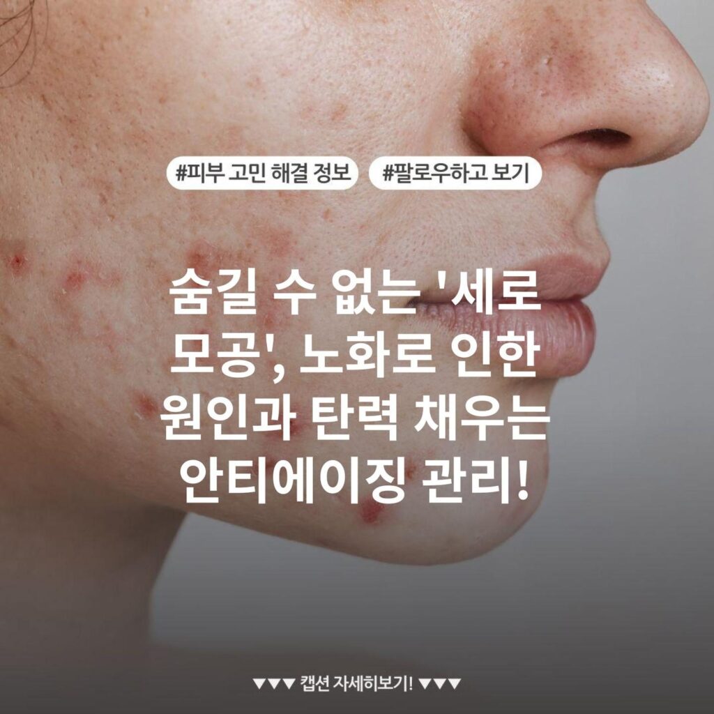 숨길 수 없는 '세로 모공', 노화로 인한 원인과 탄력 채우는 안티에이징 관리!