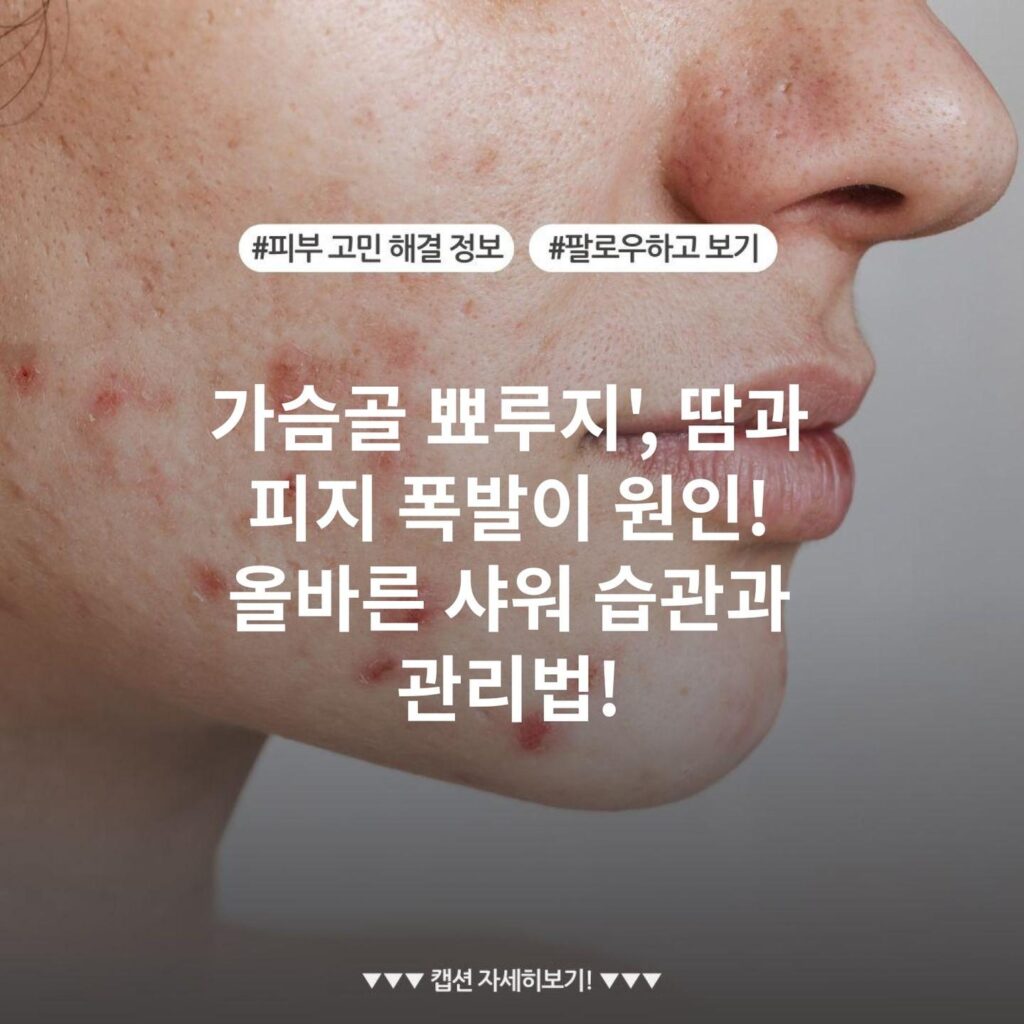 가슴골 뾰루지', 땀과 피지 폭발이 원인! 올바른 샤워 습관과 관리법!