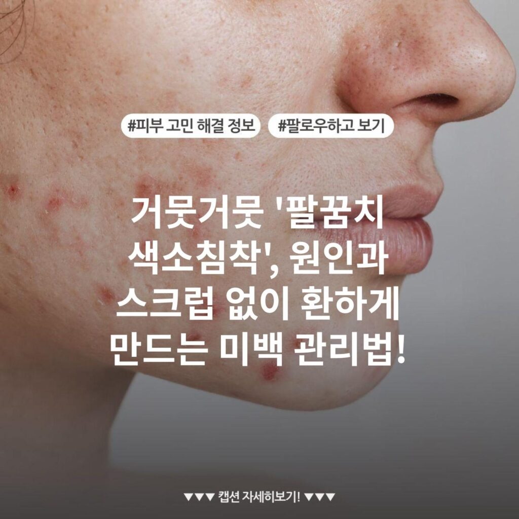 거뭇거뭇 '팔꿈치 색소침착', 원인과 스크럽 없이 환하게 만드는 미백 관리법!
