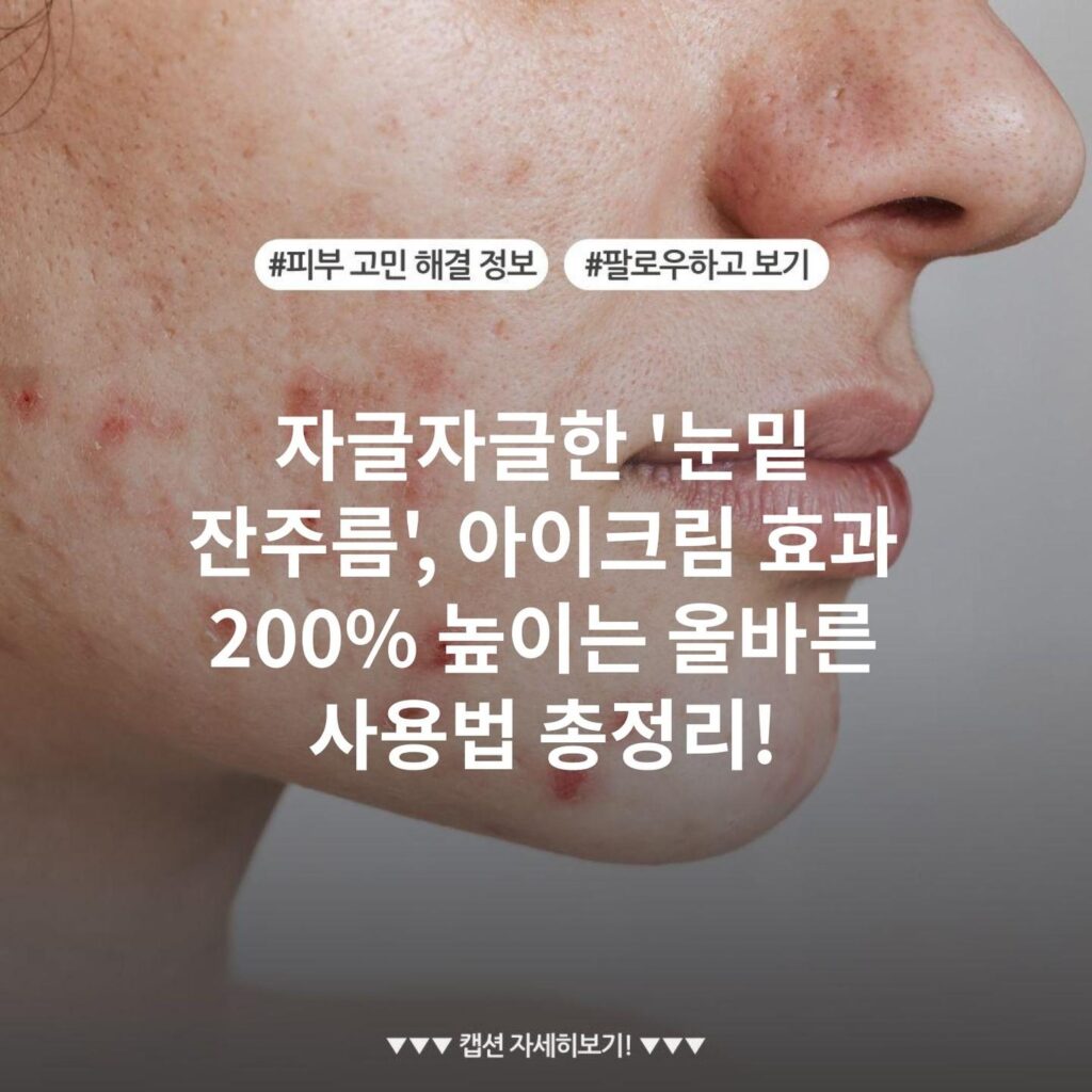 자글자글한 '눈밑 잔주름', 아이크림 효과 200% 높이는 올바른 사용법 총정리!