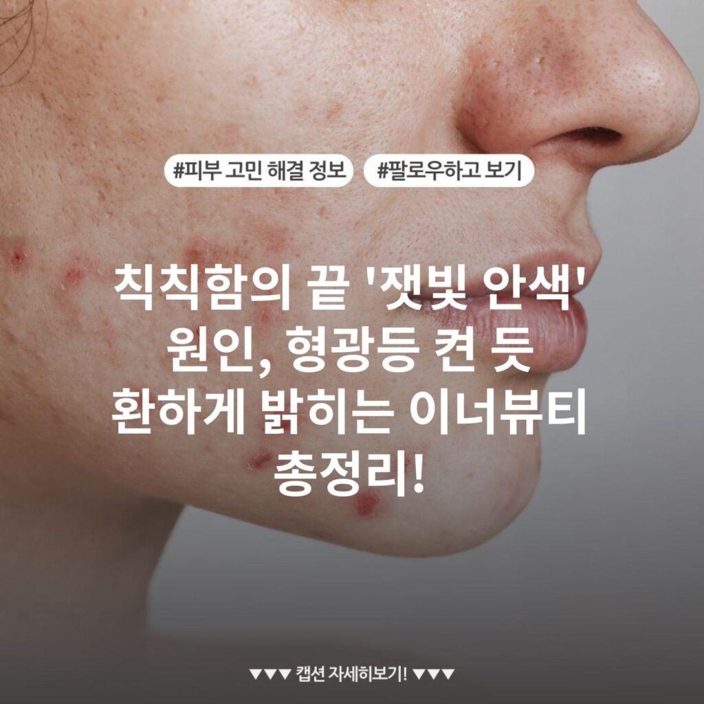 칙칙함의 끝 '잿빛 안색' 원인, 형광등 켠 듯 환하게 밝히는 이너뷰티 총정리!