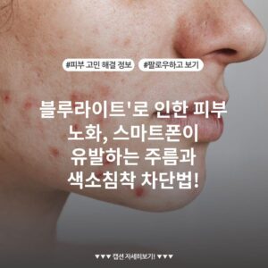 블루라이트'로 인한 피부 노화, 스마트폰이 유발하는 주름과 색소침착 차단법!