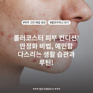 롤러코스터 피부 컨디션' 안정화 비법, 예민함 다스리는 생활 습관과 루틴!