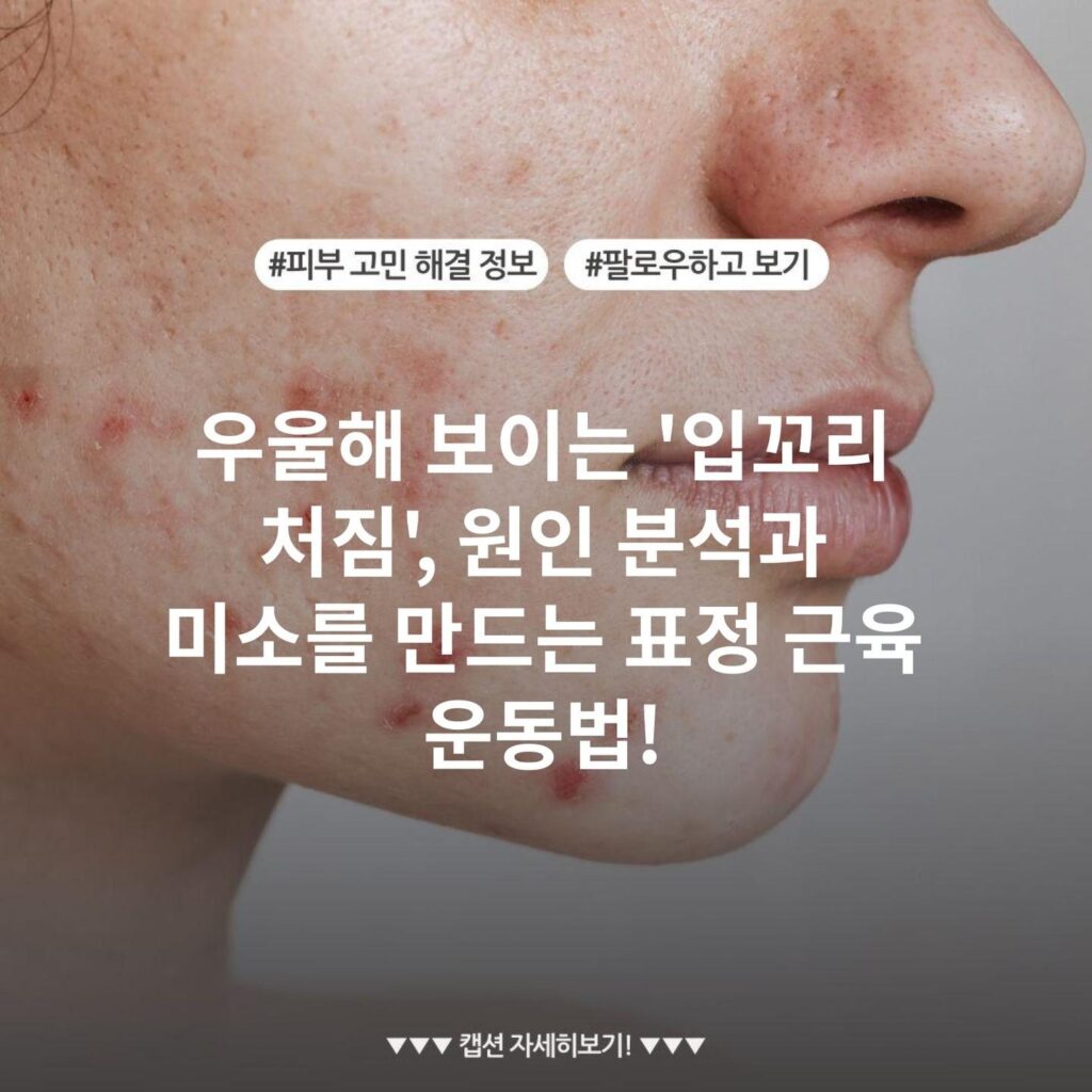 우울해 보이는 '입꼬리 처짐', 원인 분석과 미소를 만드는 표정 근육 운동법!