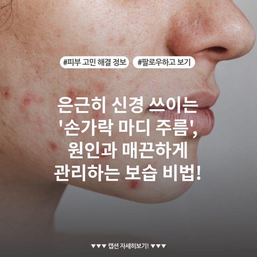 은근히 신경 쓰이는 '손가락 마디 주름', 원인과 매끈하게 관리하는 보습 비법! - STYLE.CHEC